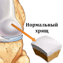 Arthron Meridian - чем лечить грибок стопы